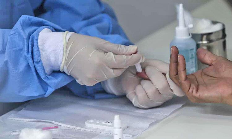 پیشگیری از کرونا بدون واکسن: ساختن آنتی بادی های که ممکن پیشگیری از کرونا بدون واکسن: ساختن آنتی بادی های که ممکن است باعث حفاظت در برابر کرونا شوند