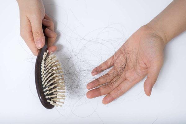 6 توجیه پزشکی درباره ریزش دائمی موها